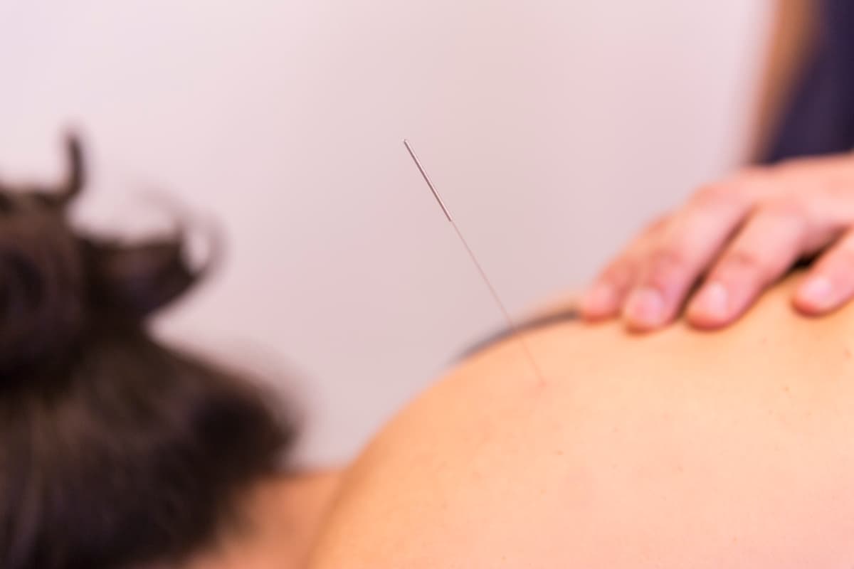Técnica de Electrolisis Percutánea Intratisular (EPI)